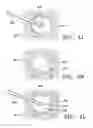 Fig. 10 - Subcutaneous cavity marking device