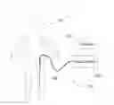 Fig. 01 - Systems and methods for analysis and treatment of an occluded body lumen