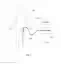 Fig. 02 - Systems and methods for analysis and treatment of an occluded body lumen