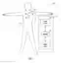 Fig. 02 - IMPLANTABLE MEDICAL DEVICE SENSING WIRELESS ECG AS SUBSTITUTE FOR INTRACARDIAC ELECTROGRAM