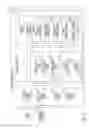 Fig. 12 - IMPLANTABLE MEDICAL DEVICE SENSING WIRELESS ECG AS SUBSTITUTE FOR INTRACARDIAC ELECTROGRAM