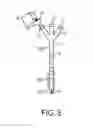 Fig. 04 - Access needle pressure sensor device and method of use
