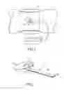 Fig. 02 - Biomedical interface pressure transducer for medical tourniquets