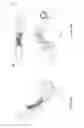 Fig. 06 - ARTICULATED MASSAGE DEVICE