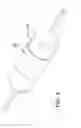 Fig. 06 - High strength balloon cover