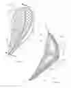 Fig. 02 - URINARY INCONTINENCE DEVICE
