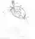 Fig. 01 - Method and Apparatus for the Containment of a Surgical Site