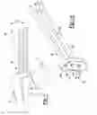 Fig. 02 - Apparatus for repairing bone defects