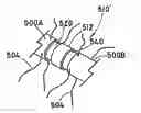 Fig. 01 - Method for open surgical placement