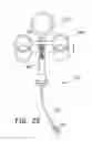 Fig. 13 - Method for open surgical placement