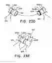 Fig. 15 - Method for open surgical placement