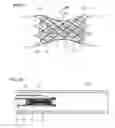 Fig. 04 - SYSTEMS AND DEVICES FOR INTRALUMENAL IMPLANTATION