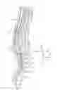 Fig. 01 - Multi-durometer reinforced suture sleeve