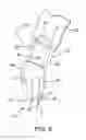 Fig. 07 - MULTI-LOOP ADJUSTABLE KNOTLESS ANCHOR ASSEMBLY AND METHOD FOR REPAIR