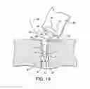Fig. 09 - MULTI-LOOP ADJUSTABLE KNOTLESS ANCHOR ASSEMBLY AND METHOD FOR REPAIR