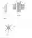Fig. 02 - SPINAL IMPLANTABLE DEVICES MADE OF CARBON COMPOSITE MATERIALS AND USE THEREOF