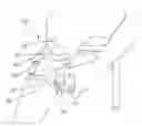 Fig. 01 - Orthosis for gait modulation