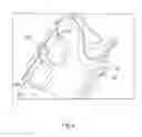Fig. 06 - Orthosis for gait modulation