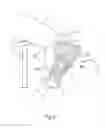 Fig. 07 - Orthosis for gait modulation