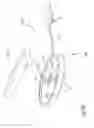 Fig. 12 - Orthosis for gait modulation