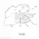 Fig. 16 - Orthosis for gait modulation
