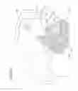 Fig. 17 - Orthosis for gait modulation