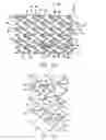 Fig. 04 - Intravascular Stent
