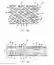 Fig. 07 - Intravascular Stent