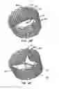 Fig. 04 - Methods and Apparatus for Endovascularly Replacing a Patient's Heart Valve