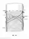 Fig. 07 - Methods and Apparatus for Endovascularly Replacing a Patient's Heart Valve