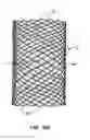 Fig. 10 - Methods and Apparatus for Endovascularly Replacing a Patient's Heart Valve
