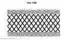 Fig. 16 - Methods and Apparatus for Endovascularly Replacing a Patient's Heart Valve