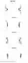 Fig. 20 - Methods and Apparatus for Endovascularly Replacing a Patient's Heart Valve