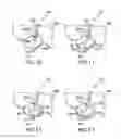 Fig. 07 - System and method to design structure for delivering electrical energy to tissue