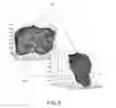 Fig. 09 - System and method for correcting data for deformations during image-guided surgical procedures