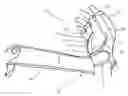 Fig. 01 - SECURING APPARATUS FOR A HAND PROTECTIVE DEVICE