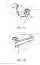 Fig. 07 - SECURING APPARATUS FOR A HAND PROTECTIVE DEVICE