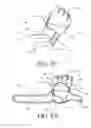 Fig. 08 - SECURING APPARATUS FOR A HAND PROTECTIVE DEVICE