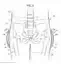 Fig. 06 - PROTECTOR