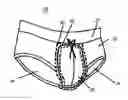Fig. 01 - Adjustable Undergarment Device and Method