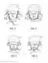 Fig. 05 - Helmet Retention System