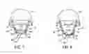 Fig. 07 - Helmet Retention System