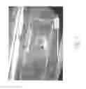 Fig. 08 - MEMS device and method for delivery of therapeutic agents