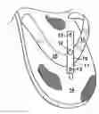 Fig. 01 - Decorative device for thong sandal