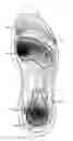 Fig. 01 - Shoe assembly with non-linear viscous liquid