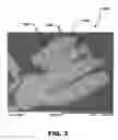 Fig. 04 - ABRASIVE SEGMENT COMPRISING ABRASIVE AGGREGATES INCLUDING SILICON CARBIDE PARTICLES