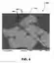 Fig. 05 - ABRASIVE SEGMENT COMPRISING ABRASIVE AGGREGATES INCLUDING SILICON CARBIDE PARTICLES