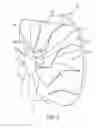 Fig. 04 - Nozzled turbocharger turbine and associated engine and method