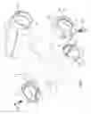 Fig. 02 - Grip for handlebars of a bicycle and similar vehicle and method therefore