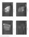 Fig. 11 - Natural crystalline colorant and process for production